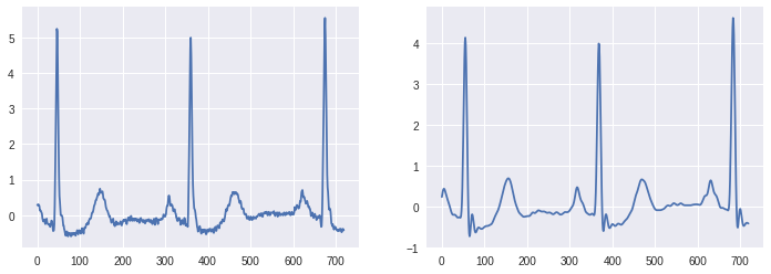 ../_images/notebooks_08_Sequential_Data_Analysis_with_Deep_Learning_123_0.png